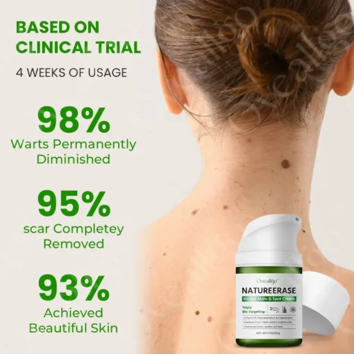 Oveallgo™ NatureErase Instant Mole & Spot Cream