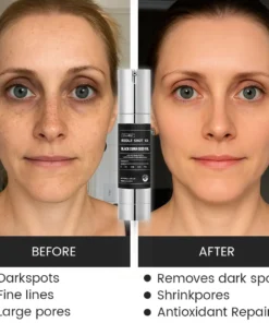 Oveallgo® Korean HerbErase Reedle Shot 100 Black Cumin Seed Oil Dark Spot Corrector Serum