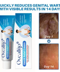 Oveallgo® HPV Genital Warts Relief Cream