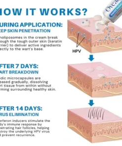Oveallgo® HPV Genital Warts Relief Cream
