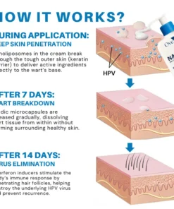 Oveallgo® NanoLipo HPV Genital Warts Eraser Cream