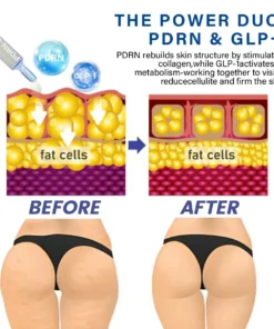 Oveallgo® PDRN-GLP-1 Slimming & Blood Sugar Regulating Reedle Shot Serum