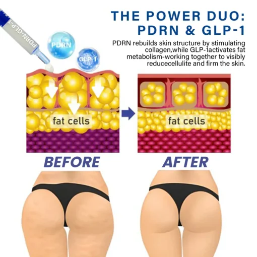 Oveallgo® PDRN-GLP-1 Slimming & Blood Sugar Regulating Reedle Shot Serum