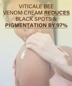 Oveallgo® VitiClear Bee Venom Cream