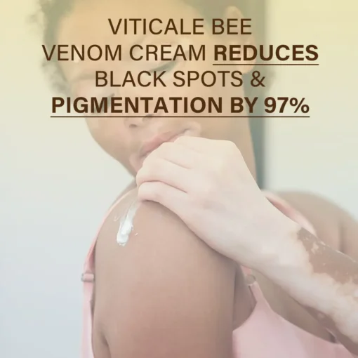 Oveallgo® VitiClear Bee Venom Cream