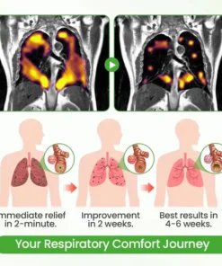 Oveallgo® Breatheora Mullein Lung Purifier