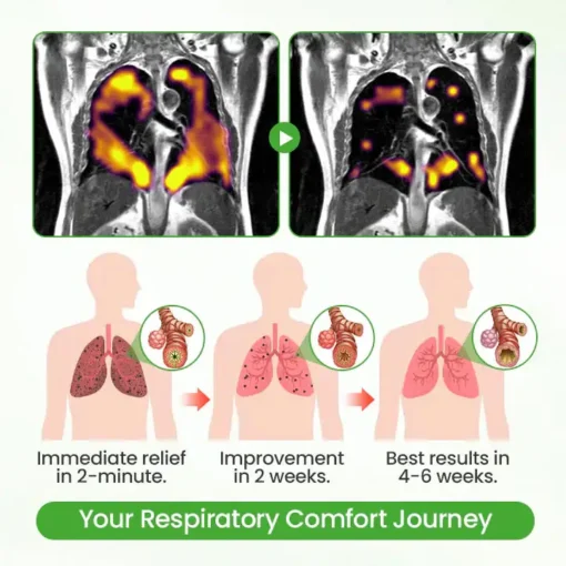 Oveallgo® Breatheora Mullein Lung Purifier