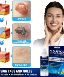 Oveallgo® ClearFrost Cryo Treatment Spray