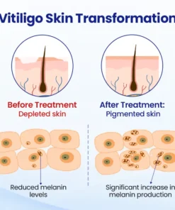 Oveallgo® Evenora Herbal Spray