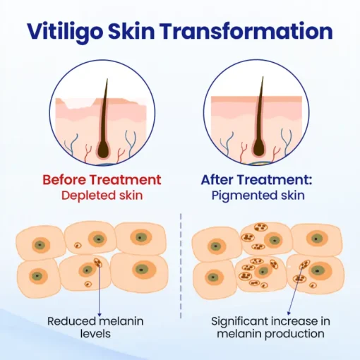 Oveallgo® Evenora Herbal Spray