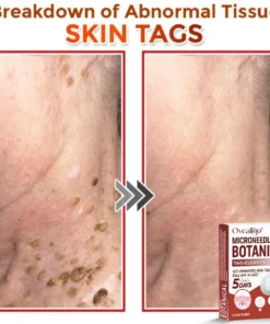 Oveallgo® MicroNeedle Botanical Tag-Clear Patch Pro