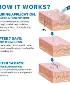 Oveallgo® NANOLIPO GENITAL WARTS CLINICAL AMPOULES