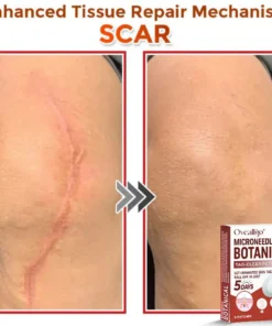 Oveallgo® Intensive MicroNeedle Botanical Tag-Clear Patch