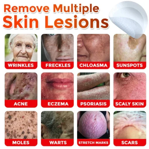 Oveallgo® Intensive MicroNeedle Botanical Tag-Clear Patch