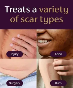 Oveallgo® Advanced Scar Gel