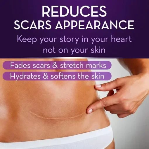 Oveallgo® Advanced Scar Gel