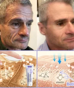 Oveallgo® Anti-Wrinkle Cream To Eliminate Wrinkles, Firm And Whiten The Skin