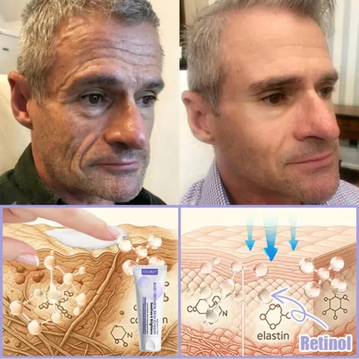 Oveallgo® Anti-Wrinkle Cream To Eliminate Wrinkles, Firm And Whiten The Skin