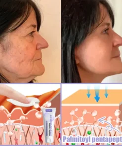 Oveallgo® Anti-Wrinkle Cream To Eliminate Wrinkles, Firm And Whiten The Skin