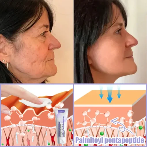 Oveallgo® Anti-Wrinkle Cream To Eliminate Wrinkles, Firm And Whiten The Skin