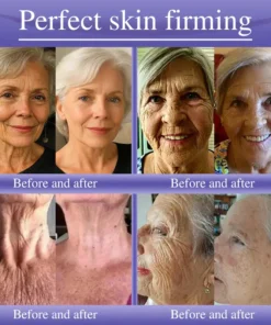 Oveallgo® Anti-Wrinkle Cream To Eliminate Wrinkles, Firm And Whiten The Skin