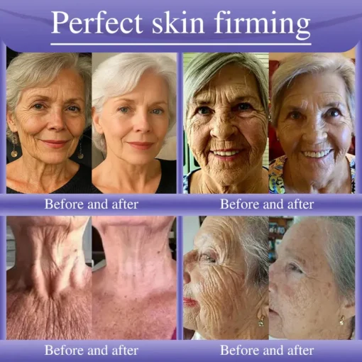 Oveallgo® Anti-Wrinkle Cream To Eliminate Wrinkles, Firm And Whiten The Skin