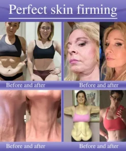 Oveallgo® Anti-Wrinkle Cream To Eliminate Wrinkles, Firm And Whiten The Skin
