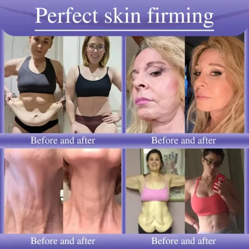 Oveallgo® Anti-Wrinkle Cream To Eliminate Wrinkles, Firm And Whiten The Skin