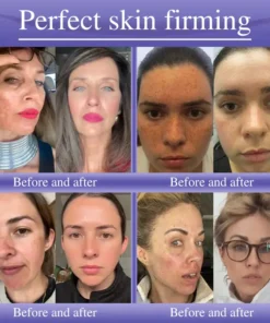 Oveallgo® Anti-Wrinkle Cream To Eliminate Wrinkles, Firm And Whiten The Skin