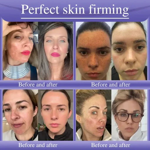 Oveallgo® Anti-Wrinkle Cream To Eliminate Wrinkles, Firm And Whiten The Skin