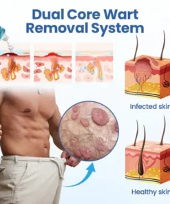Oveallgo® GentX PRO WartRelief Cream