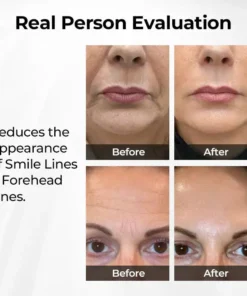 Oveallgo® TightShift Precision Contour & Firming Serum