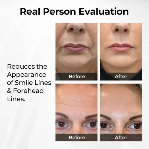 Oveallgo® TightShift Precision Contour & Firming Serum
