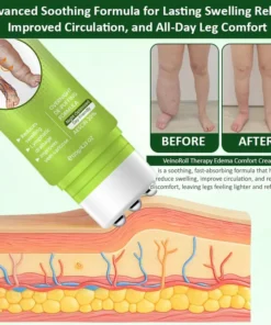 Oveallgo® VeinoRoll Therapy Edema Comfort Cream
