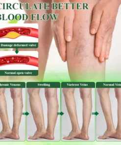 Oveallgo® VeinoRoll Therapy Edema Comfort Cream
