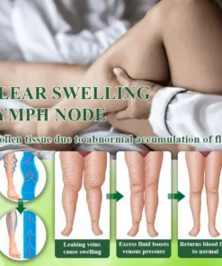 Oveallgo® VeinoRoll Therapy Edema Comfort Cream