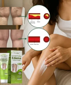 Oveallgo® VeinoRoll Therapy Edema Comfort Cream
