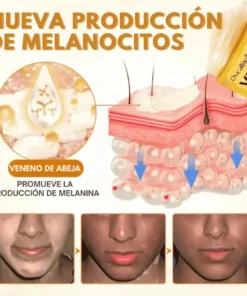 Oveallgo® VitiClear Pro Veneno de Abeja