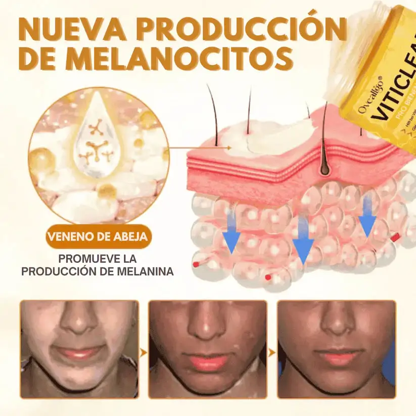 Oveallgo® VitiClear Pro Veneno de Abeja