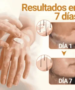 Oveallgo® VitiClear Pro Veneno de Abeja