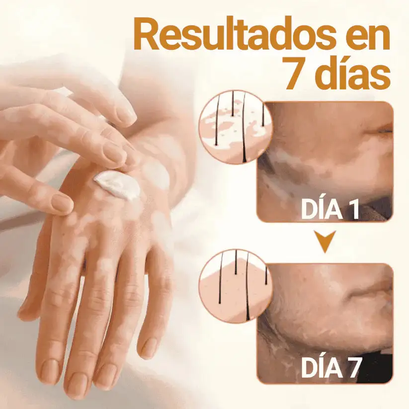 Oveallgo® VitiClear Pro Veneno de Abeja