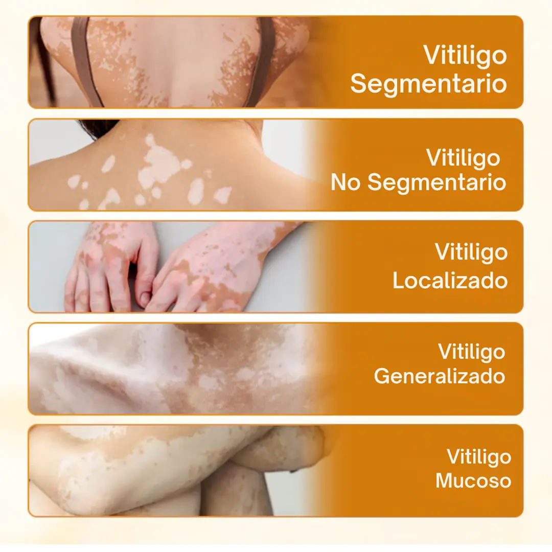 Oveallgo® VitiClear Pro Veneno de Abeja