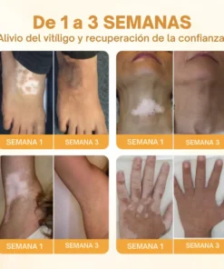 Oveallgo® VitiClear Pro Veneno de Abeja