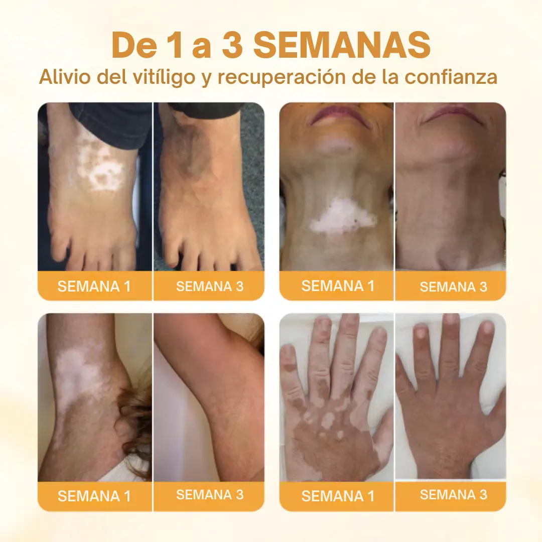 Oveallgo® VitiClear Pro Veneno de Abeja