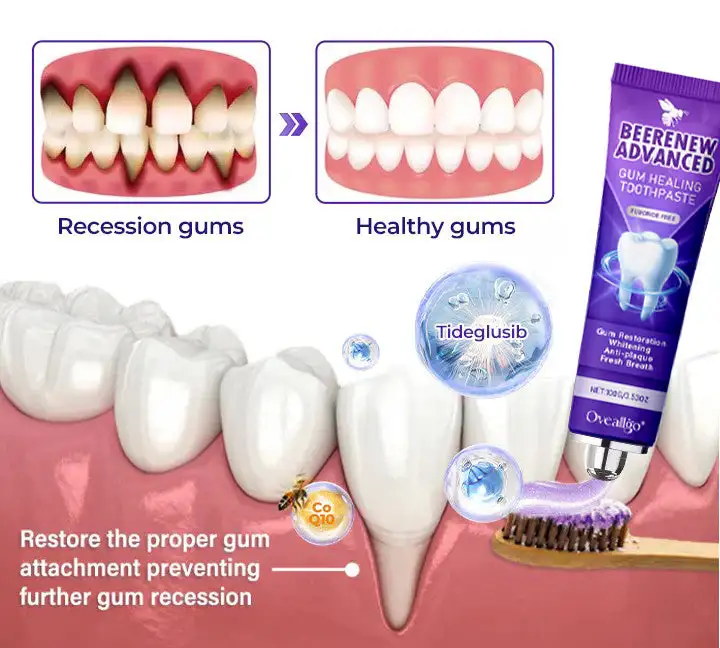 Oveallgo® BeeRenew Advanced Gum Healing Toothpaste