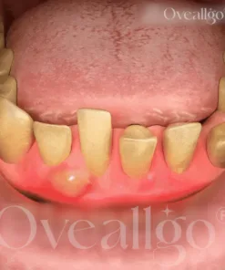 Oveallgo® BeeRenew Advanced Gum Healing Toothpaste