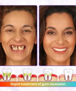 Oveallgo® BeeRenew Advanced Gum Healing Toothpaste