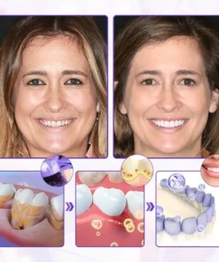 Oveallgo® BeeRenew Advanced Gum Healing Toothpaste