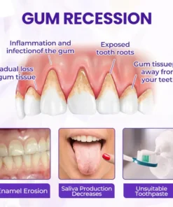 Oveallgo® BeeRenew Advanced Gum Healing Toothpaste