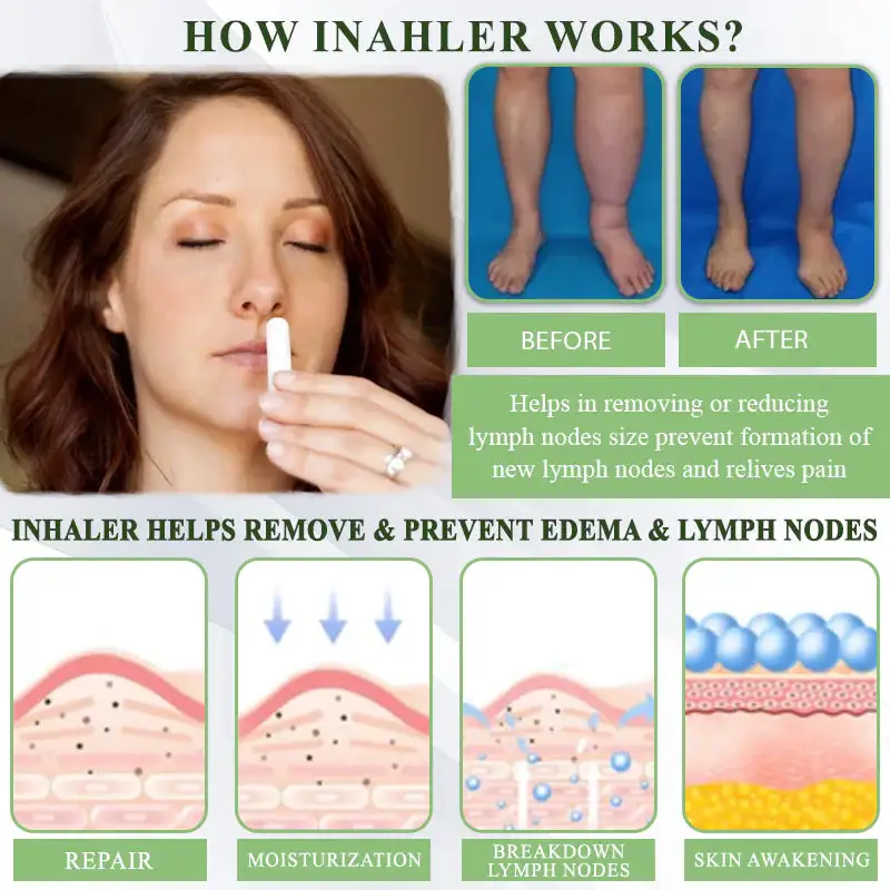 Oveallgo® CircuPro Edema & Lymphatic Support Inhaler